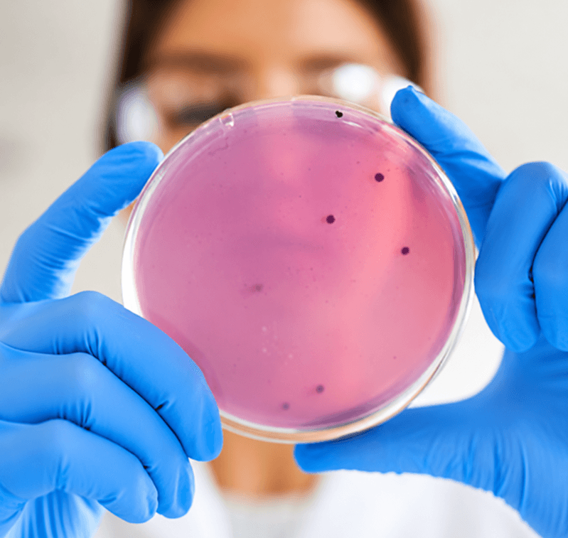 Scientist in laboratory gloves examining a culture medium in a petri dish